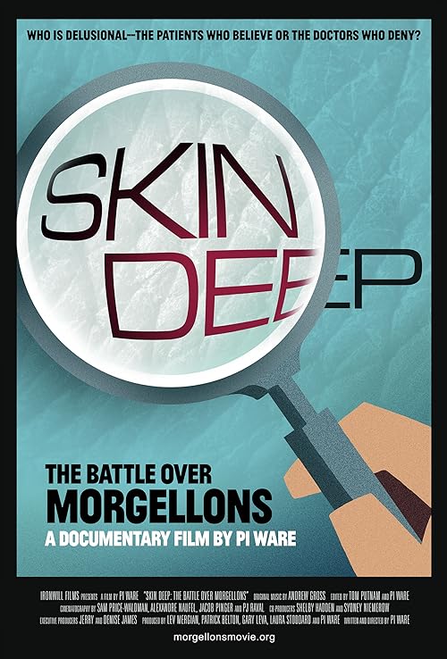 دانلود مستند Skin Deep: The Battle Over Morgellons 2019 ( پوست عمیق: نبرد بر سر مورگولون ها ۲۰۱۹ ) با لینک مستقیم